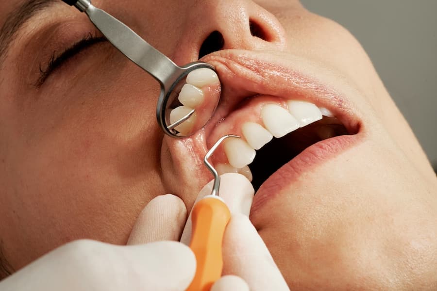Blog - que es gingivitis periodontitis