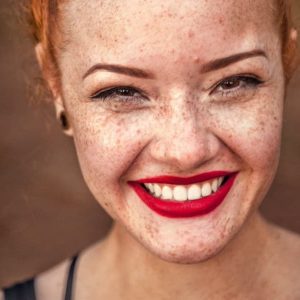 Est&eacute;tica dental en Terrassa - que es odontologia estetica 300x300