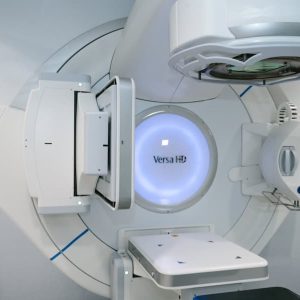 Est&eacute;tica dental en Terrassa - como cuidar los dientes radioterapia 300x300