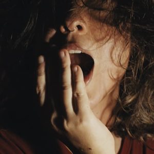 Periodoncia en Terrassa - causas principales dolores muela 300x300