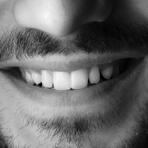 Periodoncia en Terrassa - que es un raspado periodental 300x300