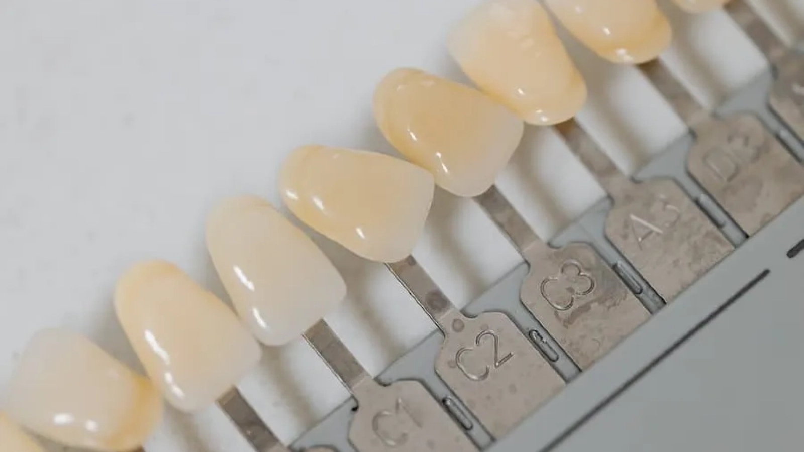 carillas dentales para que sirven