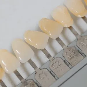 Est&eacute;tica dental en Terrassa - que son carillas dentales 300x300