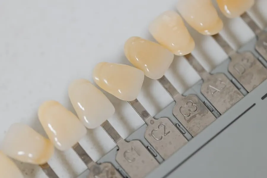 carillas dentales para que sirven