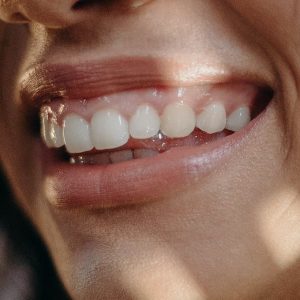 Periodoncia en Terrassa - por que sangran las encias 300x300