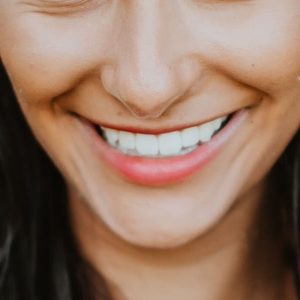 Est&eacute;tica dental en Terrassa - como mantener los dientes sanos 300x300