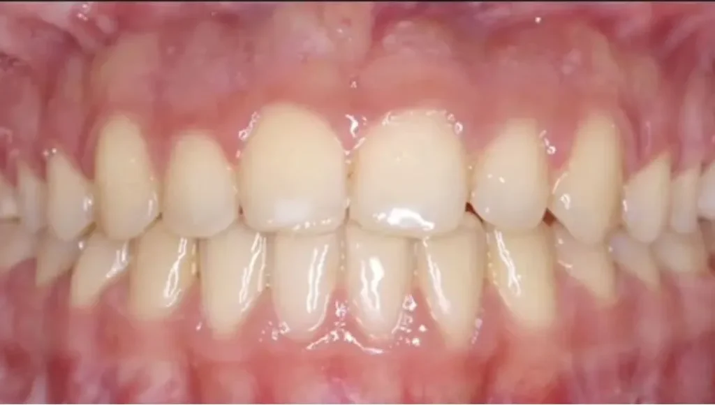 Odontopediatr&iacute;a en Terrassa - 3 2 1024x580