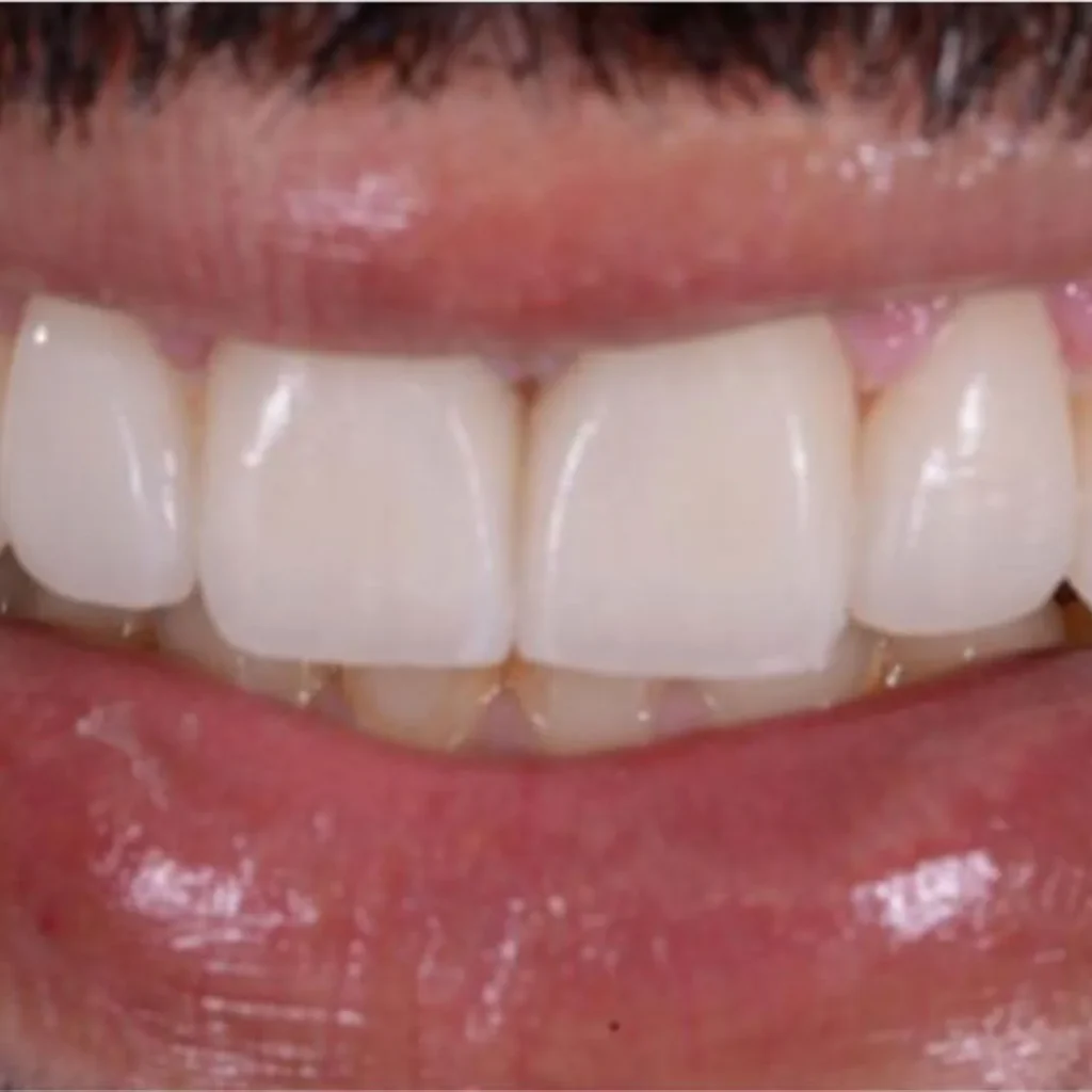 Ortodoncia en Terrassa - 4 2 1024x1024