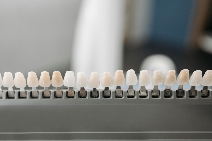 dimension vertical dientes