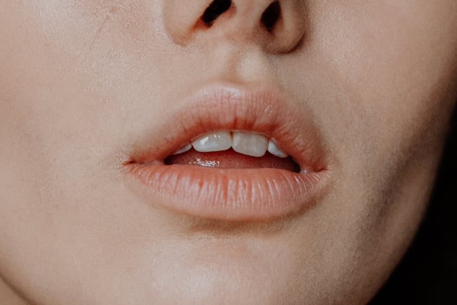 Blog - que son las aftas bucales