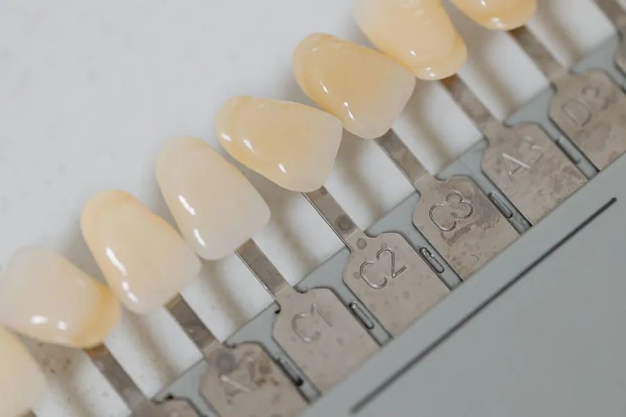 Implantes dentales en Terrassa - Implantes dentales en Terrassa 3