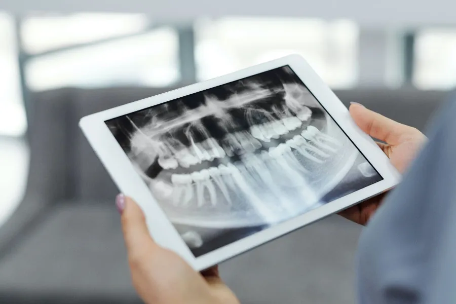Pr&oacute;tesis dental en Terrassa - Protesis dental en Terrassa 4