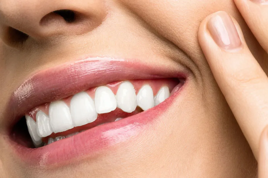 Est&eacute;tica dental en Terrassa - estetica dental terrassa 3