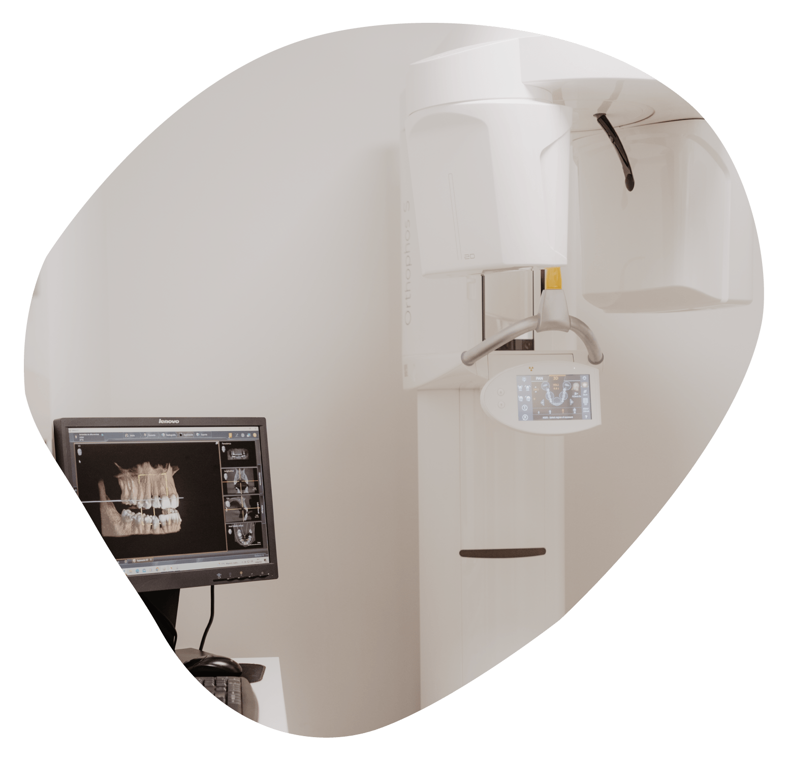 Pr&oacute;tesis dental en Terrassa - Clinica dental Dr. Montane 9