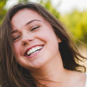 Carillas dentales en Terrassa - fluorosis dental 300x300