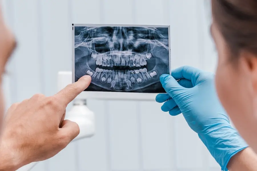 Blog - reabsorcion dental 02 2025